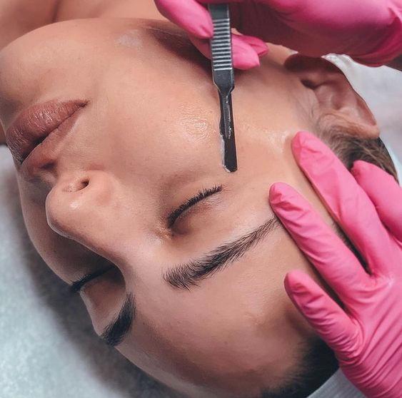 Dermaplaning